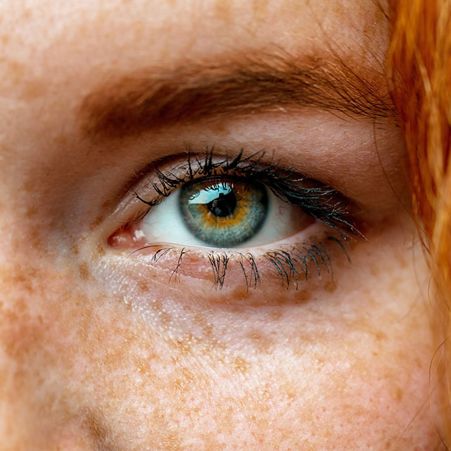 augen lasern