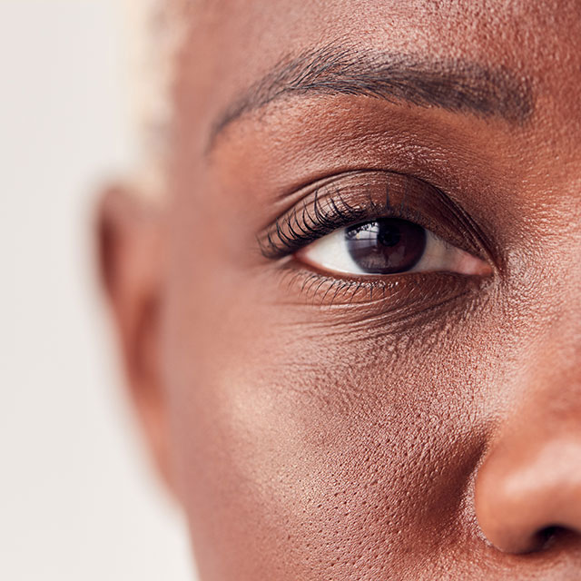 augen lasern