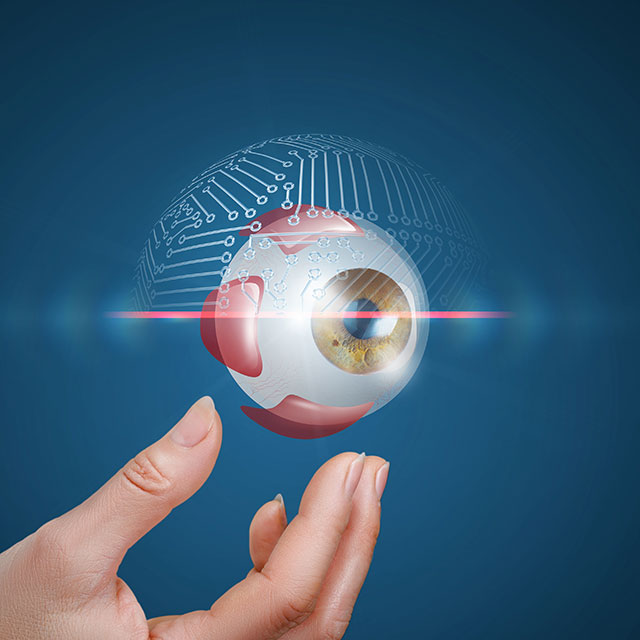 augen lasern