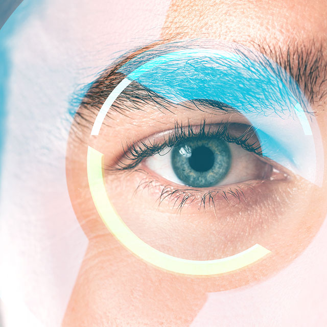 augen lasern